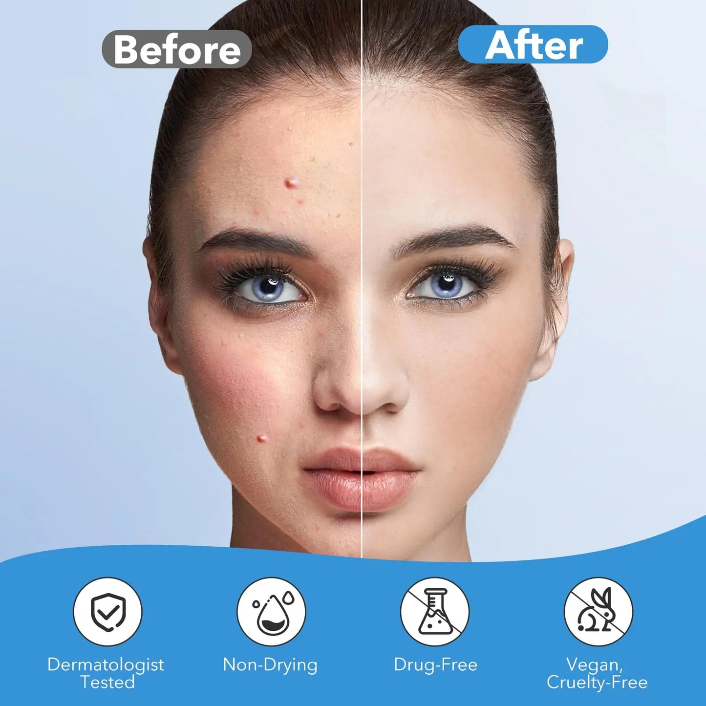 QUSTERE Pimple Patches for Face Hydrocolloid Acne Patches Versitile Cute Star Zit Covers Spot Stickers Mild and non-irritating Patches 5 Color 3 Sizes (10mm, 12mm & 14mm) |200/400 pcs Skincare Skin Repair Salicylic Tea Tree image 8
