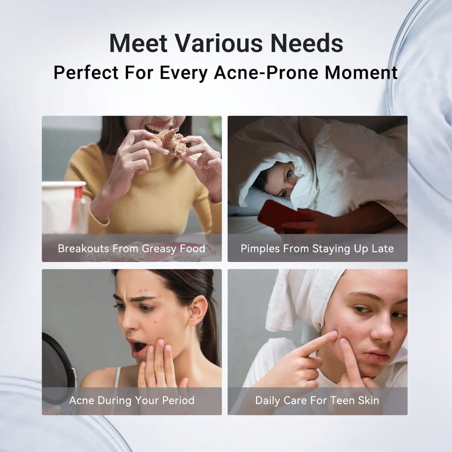 Dr.Leo Drying Lotion | Pimple Treatment & Body Acne Treatment | Visibly Shrinks Pimples in 24 Hours & Helps Fade Acne Marks in 7 Days | With 1.8% Encapsulated Salicylic Acid, 4% Niacinamide & 10% Sulfur (20ml) #DealsForYouDays,beachoutfits image 7