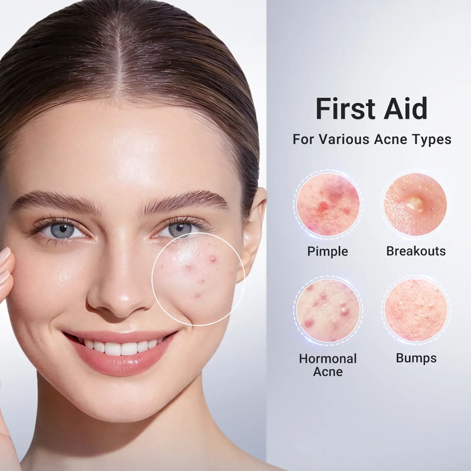 Dr.Leo Drying Lotion | Pimple Treatment & Body Acne Treatment | Visibly Shrinks Pimples in 24 Hours & Helps Fade Acne Marks in 7 Days | With 1.8% Encapsulated Salicylic Acid, 4% Niacinamide & 10% Sulfur (20ml) #DealsForYouDays,beachoutfits image 2