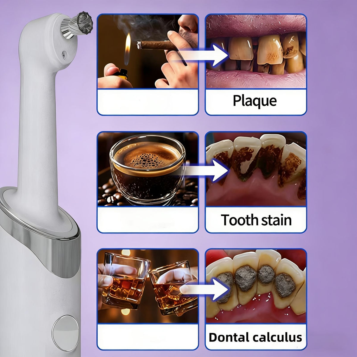 5 replacement brush heads toothbrush set teeth polishing kit image 8